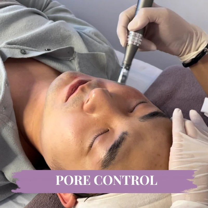 Micro-needling & Skin Boosters