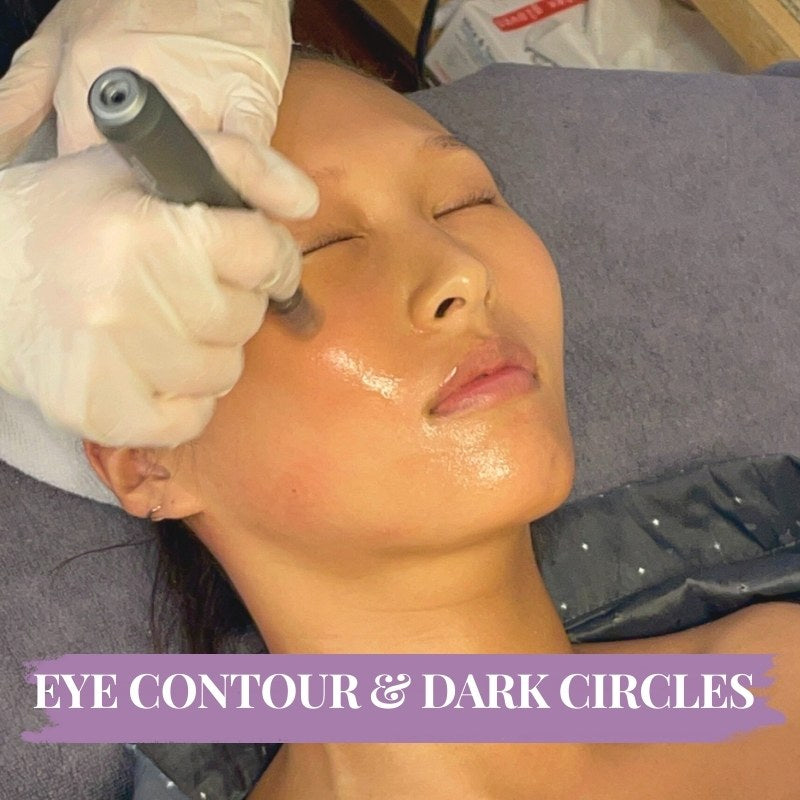 Micro-needling & Skin Boosters