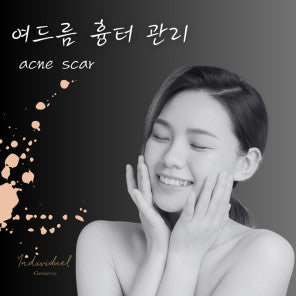 Acne Scar Treatment