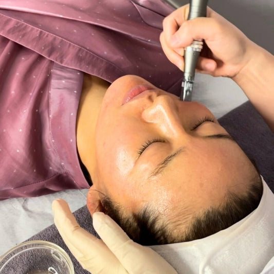 Micro-needling & Skin Boosters